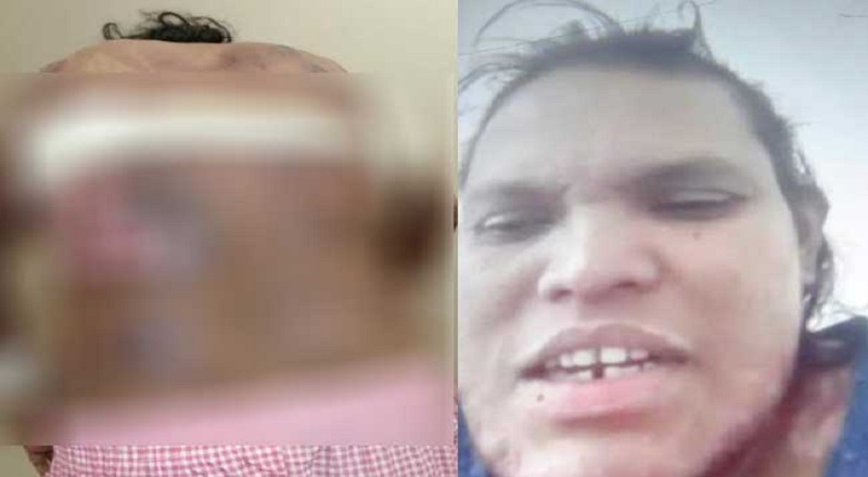 சவுதியில் இலங்கை வீட்டுப் பணிப்பெண்ணிற்கு தீவைத்து கொடூரம்