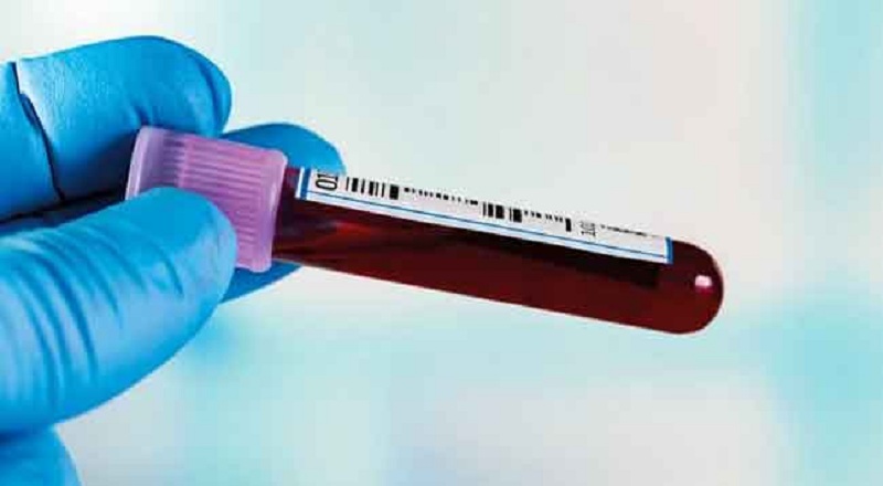 இம்யூனோகுளோபுலின் வழக்கின் சூத்திரதாரியை விரைவில் கைது செய்யுமாறு கோரிக்கை!