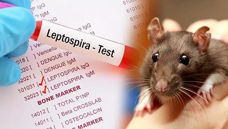 எலிக்காய்ச்சல் அறிகுறி தென்பட்டால் உடனடியாக வைத்தியசாலையை நாடவும்!