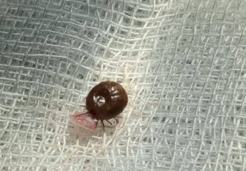 நடிகையின் காதுக்குள் பல நாட்களாக வாழ்ந்த உண்ணி பூச்சி! இறுதியில் நடந்த விபரீதம்