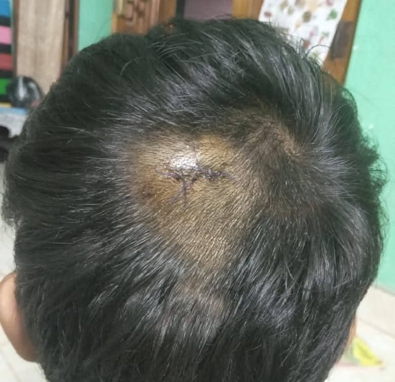 மல்லாவி வைத்தியசாலையில் மருத்துவரின் கவனயீனத்தால் பாதிக்கப்பட்ட சிறுவன்