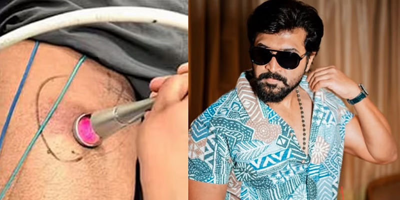 படப்பிடிப்பின் போது விபத்தில் சிக்கிய நடிகர் அருண் விஜய்