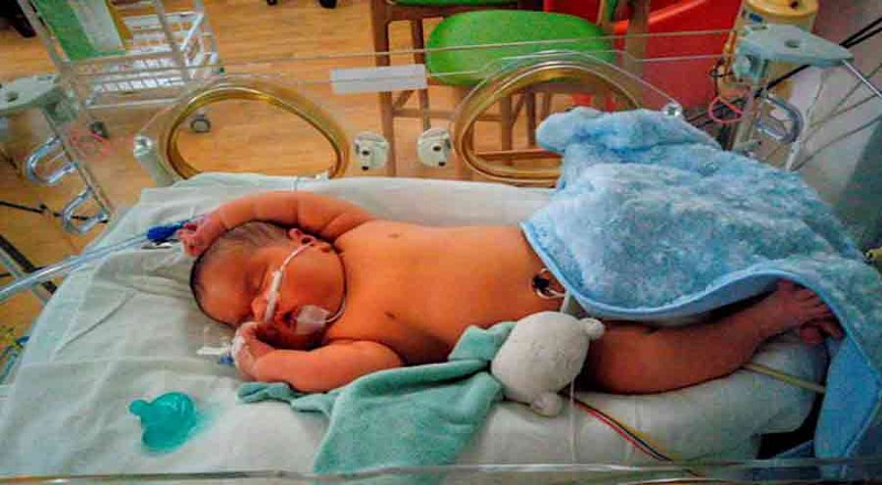 அதிக எடையுடன் பிறந்த குழந்தை