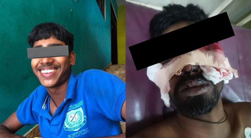 சந்தேக நபரை கண்மூடித்தனமாக சுட்ட பொலிசார்! விமர்சிக்கும் மனிதவுரிமை செயற்பாட்டாளர்கள்