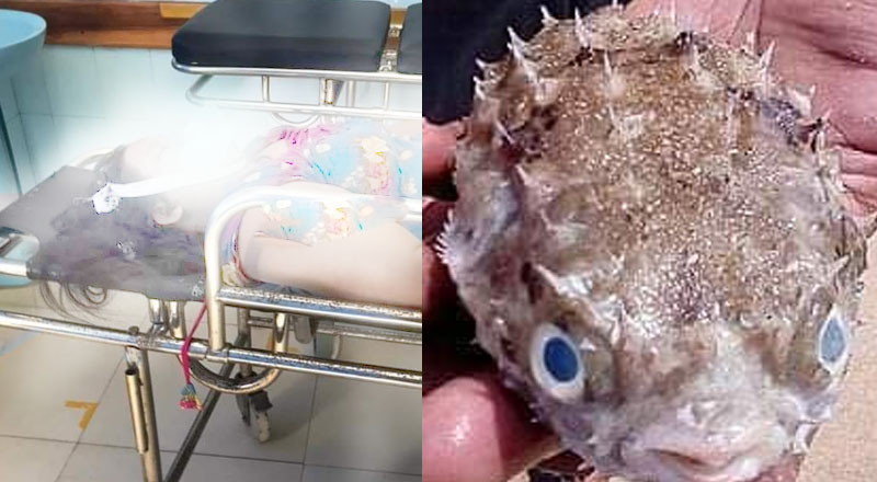 நஞ்சுத்தன்மையான கடல்மீனை உண்டதால் பெண் ஒருவர் உயிரிழப்பு! மூவர் ஆபத்தான நிலையில்