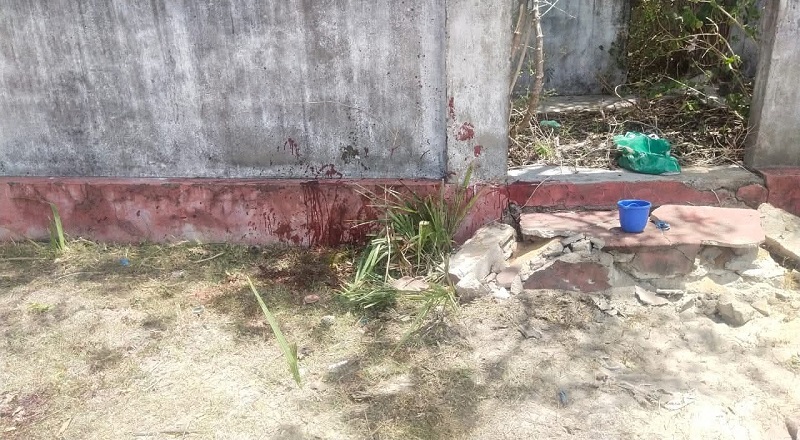 வெடிப்பு விபத்து  - தவறாக கையாளப்பட்ட  வெடி பொருள் காரணமாக வெடி விபத்தில் இருவர் படு காயம் !