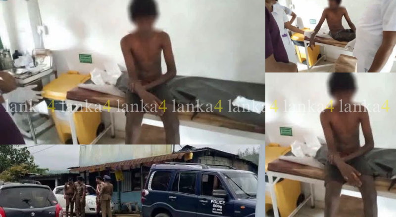 உயர் மின்னழுத்த மின்சாரம் தாக்கி இரு மாணவர்கள் பாதிப்பு – ஒருவர் தீக்காயங்களுடன் வைத்தியசாலையில் அனுமதி