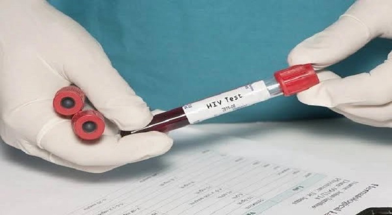 இலங்கையில் அதிகரிக்கும் எச்ஐவி தொற்று: 2025ஆம் ஆண்டில் 875 பேர் அடையாளம் காணப்பட்டனர்!