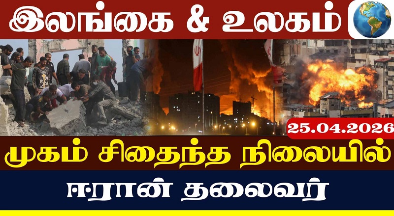 சிதைந்த நிலையில் முகம்.. செயற்கை கால்! ஈரான் தலைவரின் நிலை (வீடியோ இணைப்பு)